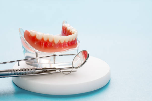 Dental Inlays and Onlays in Dallesport, WA